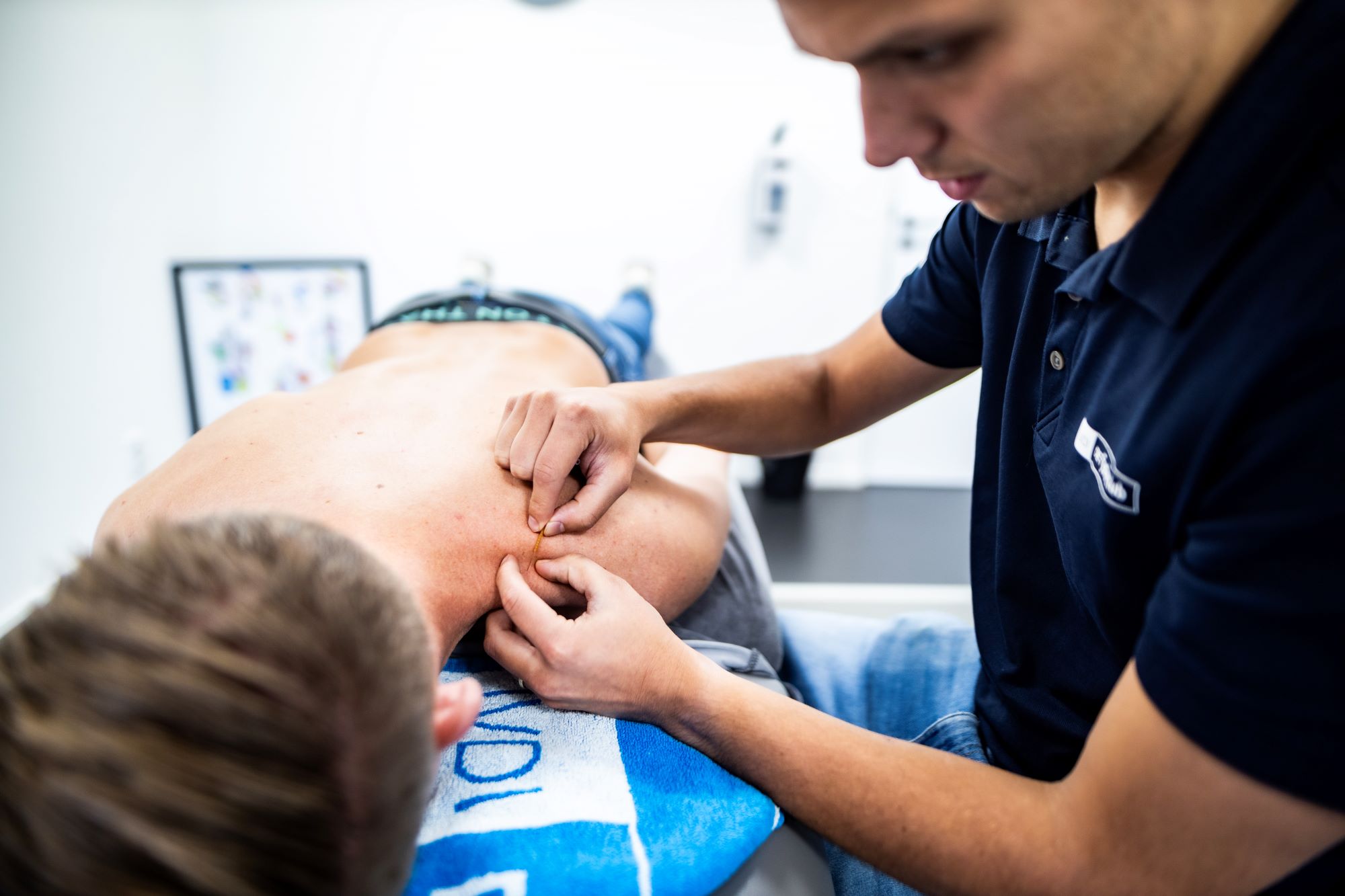 Dry needling Deurne-Mierlo-Gemert-Helmond-Geldrop-Nederweert | De Fysioclub